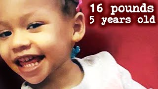 Download lagu 16 Pounds At 5 Years Old The Sickening Case of Cal... mp3