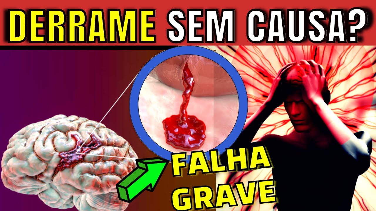 Stroke WITHOUT CAUSE: 7 HABITS THAT CAN GREATLY REDUCE YOUR RISK of having a STROKE