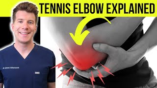 Doctor explains TENNIS ELBOW (lateral epicondylitis) | Symptoms, causes, &amp; treatment