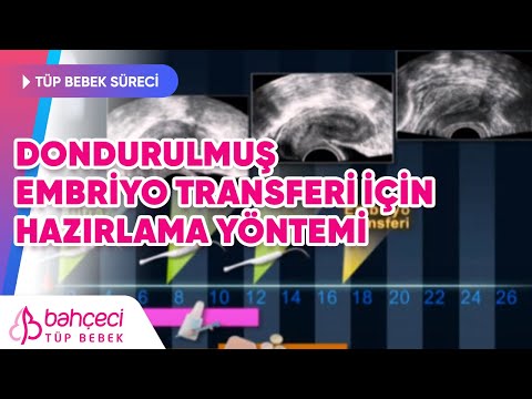 Dondurulmuş embriyo transferi için hazırlama yöntemi