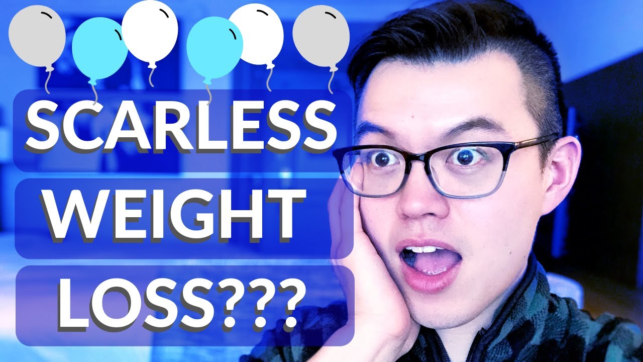 Endoscopic Weight Loss Procedures: 5 things to know about bariatric endoscopy!