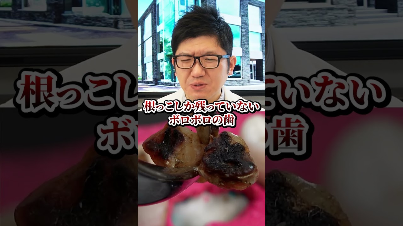 残根治療を先生が説明！#short