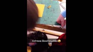 Extreme blood knuckles