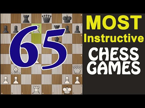 🔴Most Instructive Chess Game || Emanuel Lasker-Vasja Pirc, Moscow 1935🔴
