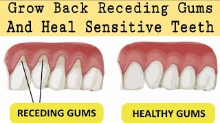 Heal Receding Gums And Grow Back | Treat Sensitive Teeths