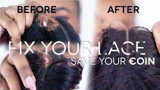 How to fix a hole in your frontal or closure FAST AND EASY! Repair your frontal!