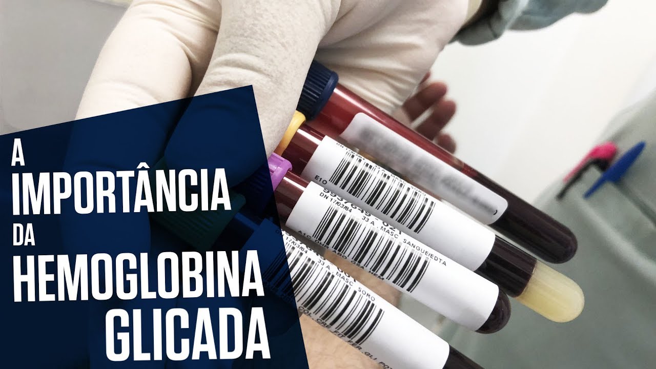 HEMOGLOBINA GLICADA – UM EXAME FUNDAMENTAL PARA SABER COMO ANDA O TRATAMENTO DO DIABETES| Tom Bueno