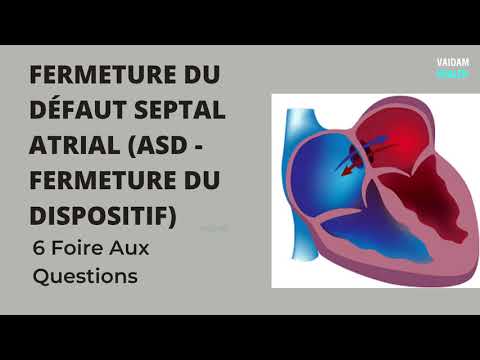 FERMETURE DU DÉFAUT SEPTAL ATRIAL (ASD - FERMETURE DU DISPOSITIF)