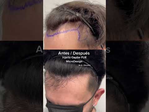 Alfredo Villanueva-18