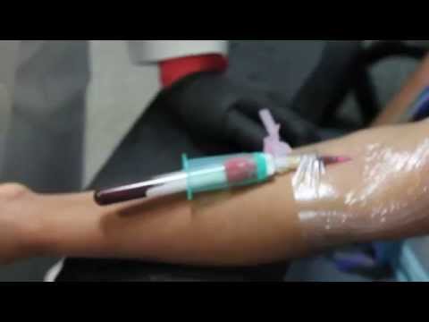 Dosis de insulina por unidad de grano La cantidad de bebidas de agua son diabéticos