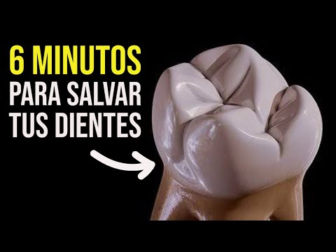 Aprende Como Limpiar Tus Dientes Para Evitar La Caries