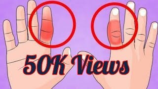 This Natural Method will Remove Swelling from Fingers & Toes| Watch this Now!|Latest|2017|English|