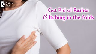 Rashes below breast fold | Remedies to Avoid itching under folds-Dr. Rajdeep Mysore| Doctors