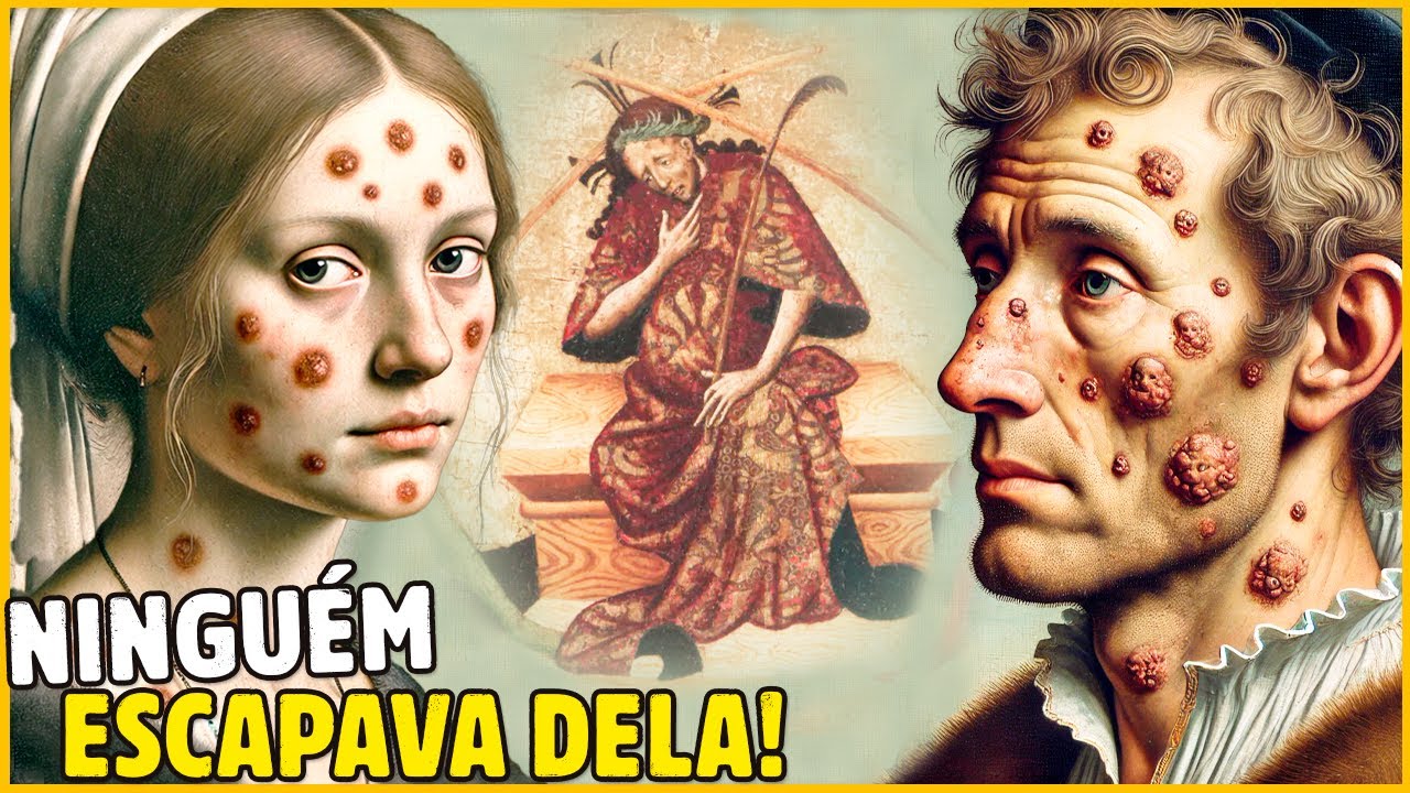 O SURTO DE SÍFILIS DE 1495: A DOENÇA MORTAL QUE VARREU A EUROPA