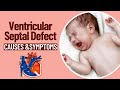 Bipasha Basu S Daughter Has Ventricular Septal Defect Know Causes And Symptoms Of This Heart Issue