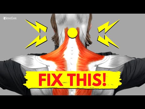 How to Fix a Snapping and Popping Neck