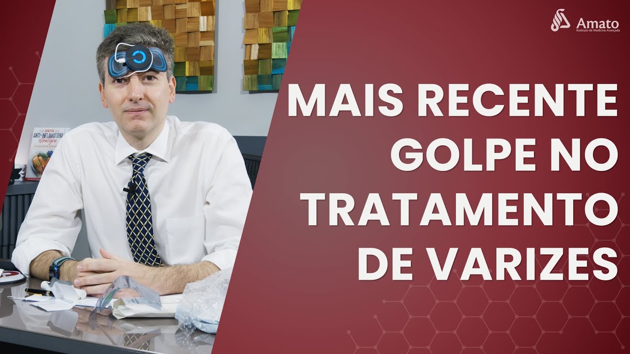 Novo golpe no tratamento de varizes! O tratamento que seu médico não sabe!