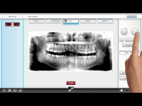 vision U - Instruction Video 06 - 2D Viewer