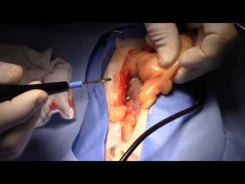 Bovie® Animal Health – Liver Biopsy