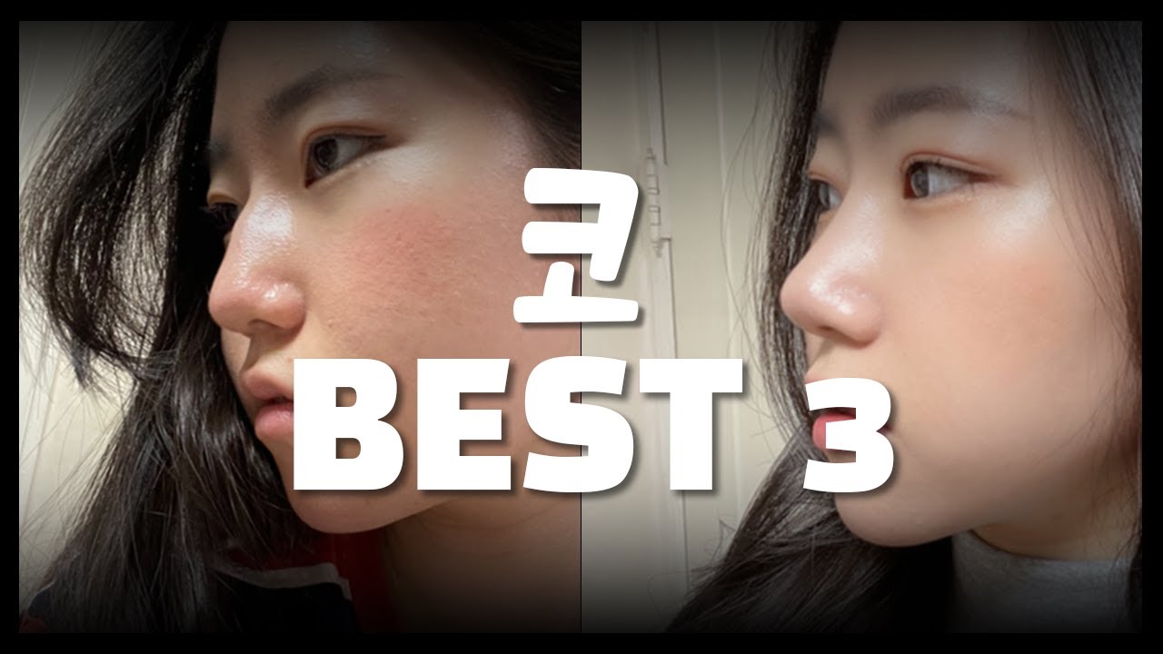 [성형후기] 코 성형 전후 BEST  3