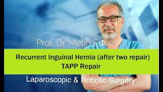 Miniaturka - Recurrent Inguinal Hernia (after two repair), TAPP Repair. Metin Ertem.MD.FACS