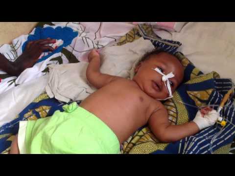 Respiratory distress signs 2