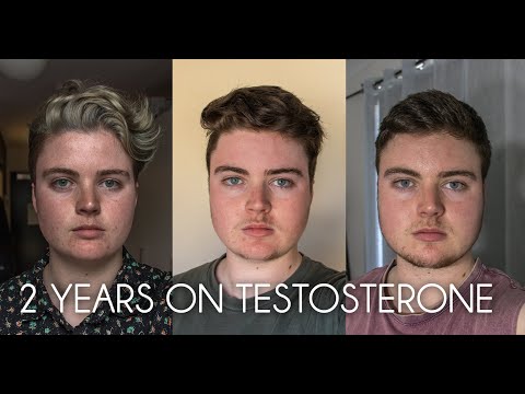 2 YEARS ON TESTOSTERONE // FTM Transgender transition australia