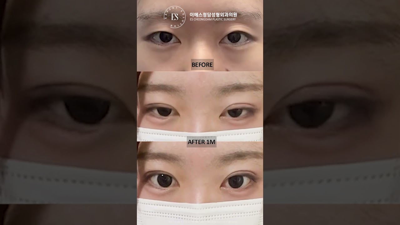 이에스 유튜브
