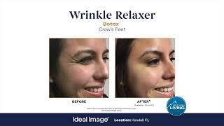 Ideal Image MedSpa
