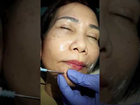 Pencegahan siswa kelebihan berat badan Adalah mungkin untuk menurunkan berat badan dengan kekuatan mandi