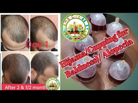 Hair fall & alopecia treatment