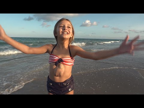 8-Year-Old With Beating Heart Outside Chest Defies The Odds