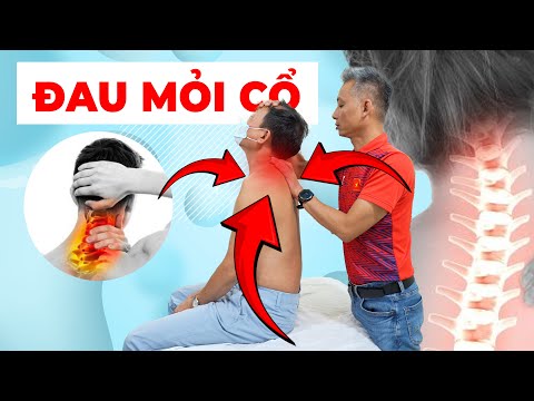 Đau Cổ Kêu Lục Cục: Tại Sao Cơn Đau Lại Tấn Công Bạn Và Làm Sao Để Xử Lý?