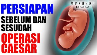 Download lagu Caesarean Section Preparation | #PKUEDU mp3