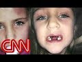 Dentist accused of abusing children, unwanted procedures