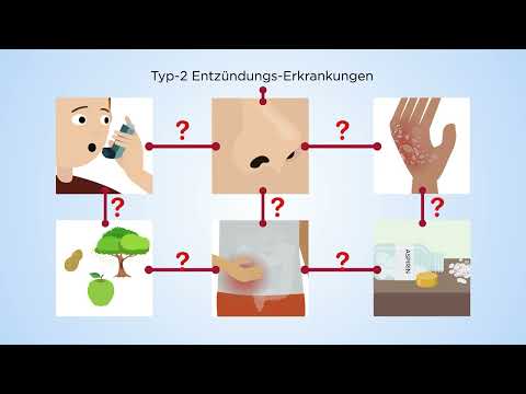 Eosinophile Erkrankungen Ist es mehr als nur Asthma