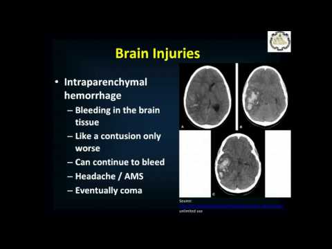 Head and Spinal Injuries