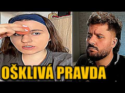 TERKO UPŘÍMNÝ ROZHOVOR