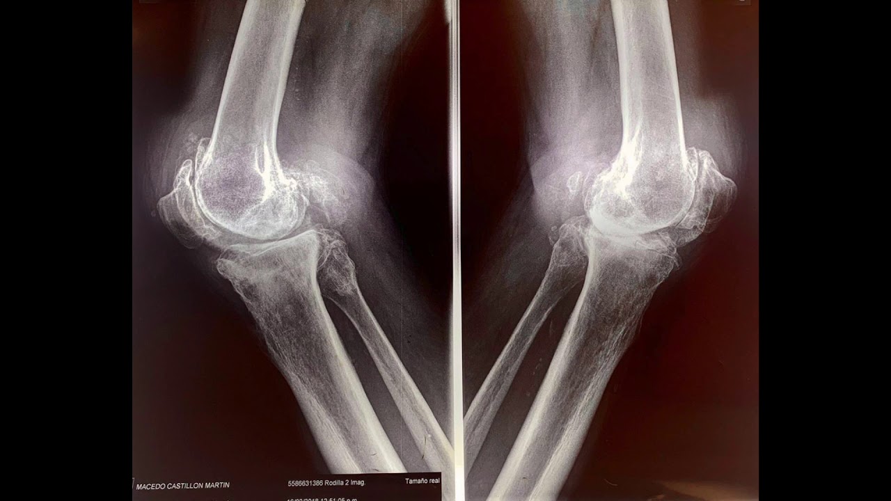 Artemio González Sánchez-6