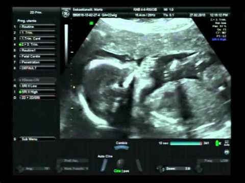 Suck the big toe (si succhia l'alluce)