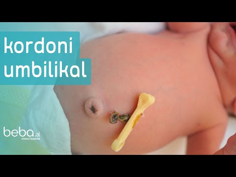 Kujdesi per kordonin Umbilikal - Pediatre Alketa Hoxha