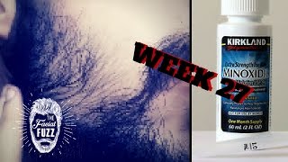 Minoxidil Beard | Week 27 | The Experiment | #Facialfuzzfridays
