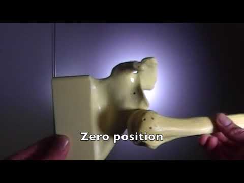 anatomy in dislocation