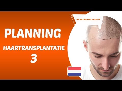 Planning Haartransplantatie3 - Dr Hamid AYDIN