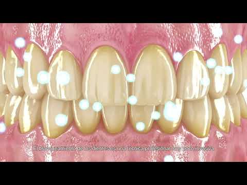 DentTV presenta: El blanqueamiento dental
