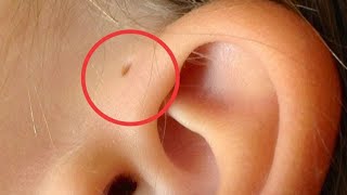Only A Handful Of People Have These Tiny Holes By Their Ears – And Here’s The Fascinating Reason Why