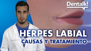 Tratamiento del HERPES LABIAL, causas y síntomas de la CALENTURA en el labio | Dentalk! ©