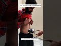 Fix Navel Displacement Navel Naveldisplacementtreatment Naveldisplacement Naveldisplacement