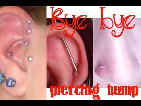 How to get rid of a piercing bump!