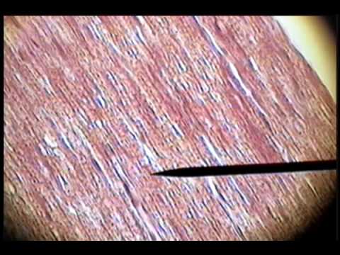 Slide 43 - Nerve Fiber